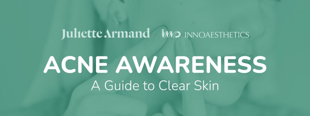 Acne Awareness Blog Header