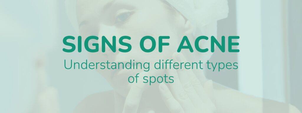 Signs Of Acne