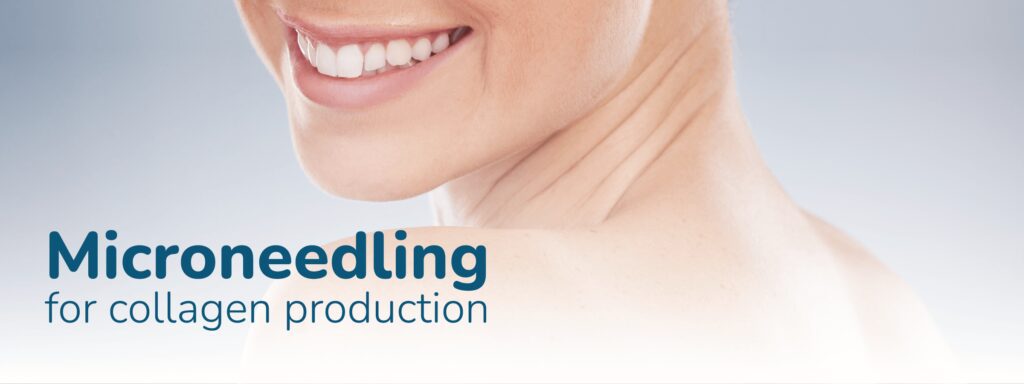 Microneedling for Collagen