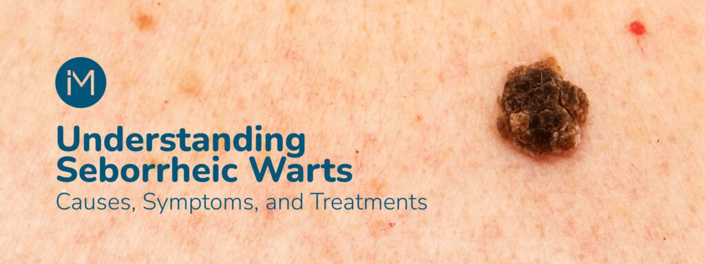 Seborrheic warts blog header